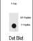 Interferon-inducible double stranded RNA-dependent protein kinase activator A antibody, abx032043, Abbexa, Western Blot image 