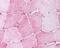 Mitogen-Activated Protein Kinase Kinase Kinase Kinase 4 antibody, 49-584, ProSci, Immunohistochemistry frozen image 