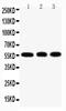 Kruppel Like Factor 4 antibody, PA2211, Boster Biological Technology, Western Blot image 