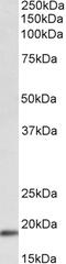 Chitinase 1 antibody, 42-918, ProSci, Western Blot image 