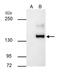 Erb-B2 Receptor Tyrosine Kinase 4 antibody, PA5-29272, Invitrogen Antibodies, Immunoprecipitation image 