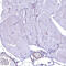 Septin 9 antibody, HPA042564, Atlas Antibodies, Immunohistochemistry paraffin image 