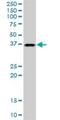 Tetratricopeptide Repeat Domain 1 antibody, H00007265-B01P, Novus Biologicals, Western Blot image 