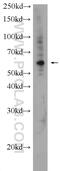 Ornithine Decarboxylase 1 antibody, 17003-1-AP, Proteintech Group, Western Blot image 