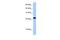 Eukaryotic Translation Initiation Factor 4E Family Member 3 antibody, PA5-41955, Invitrogen Antibodies, Western Blot image 