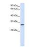 Transmembrane Protein 51 antibody, NBP1-62590, Novus Biologicals, Western Blot image 