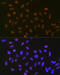 Small Ubiquitin Like Modifier 2 antibody, GTX02850, GeneTex, Immunofluorescence image 