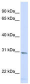 Single-strand selective monofunctional uracil DNA glycosylase antibody, TA334511, Origene, Western Blot image 