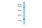 Signal Peptidase Complex Subunit 3 antibody, A13467, Boster Biological Technology, Western Blot image 