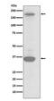 Macrophage Stimulating 1 Receptor antibody, M01532, Boster Biological Technology, Western Blot image 