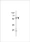 Coiled-coil domain-containing protein 149-B antibody, PA5-72621, Invitrogen Antibodies, Western Blot image 