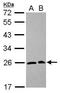 Secretion Associated Ras Related GTPase 1A antibody, GTX102204, GeneTex, Western Blot image 