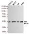 Eukaryotic Translation Initiation Factor 2 Subunit Alpha antibody, TA346937, Origene, Western Blot image 