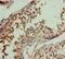 Ring Finger And FYVE Like Domain Containing E3 Ubiquitin Protein Ligase antibody, LS-C676385, Lifespan Biosciences, Immunohistochemistry paraffin image 