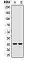 Ornithine Carbamoyltransferase antibody, LS-C667947, Lifespan Biosciences, Western Blot image 