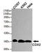 Caudal Type Homeobox 2 antibody, STJ99169, St John