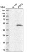 Zona Pellucida Binding Protein 2 antibody, PA5-55747, Invitrogen Antibodies, Western Blot image 