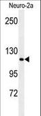 Arginine-Glutamic Acid Dipeptide Repeats antibody, LS-C162544, Lifespan Biosciences, Western Blot image 