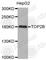 DNA Topoisomerase II Beta antibody, A3644, ABclonal Technology, Western Blot image 