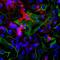 Coronin 1A antibody, M04245, Boster Biological Technology, Immunohistochemistry paraffin image 