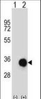 Caspase 6 antibody, LS-C168334, Lifespan Biosciences, Western Blot image 