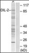 TPX2 Microtubule Nucleation Factor antibody, orb94874, Biorbyt, Western Blot image 