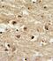 Insulin Like Growth Factor Binding Protein 2 antibody, PA5-35343, Invitrogen Antibodies, Immunohistochemistry frozen image 