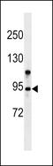 Zinc Finger MYM-Type Containing 6 antibody, LS-C157412, Lifespan Biosciences, Western Blot image 