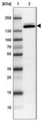 ATP Binding Cassette Subfamily C Member 11 antibody, NBP1-82623, Novus Biologicals, Western Blot image 