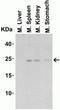 Interleukin 23 Subunit Alpha antibody, GTX85495, GeneTex, Western Blot image 