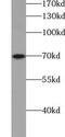 ACK1 antibody, FNab00086, FineTest, Western Blot image 