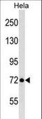 LAS1 Like, Ribosome Biogenesis Factor antibody, LS-C160031, Lifespan Biosciences, Western Blot image 