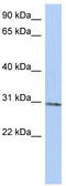 TRNA Methyltransferase 61A antibody, TA330972, Origene, Western Blot image 