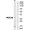 Homeobox A5 antibody, A04018-1, Boster Biological Technology, Western Blot image 