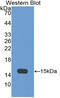 Alpha Hemoglobin Stabilizing Protein antibody, LS-C314495, Lifespan Biosciences, Western Blot image 