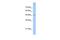 Tigger transposable element-derived protein 3 antibody, GTX46141, GeneTex, Western Blot image 