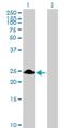 Zinc Finger Protein 486 antibody, H00090649-B01P, Novus Biologicals, Western Blot image 