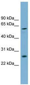Basic, Immunoglobulin-Like Variable Motif Containing antibody, TA344975, Origene, Western Blot image 