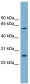 Basic, Immunoglobulin-Like Variable Motif Containing antibody, TA344975, Origene, Western Blot image 