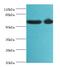 Spermatogenesis Associated Serine Rich 2 Like antibody, A61114-100, Epigentek, Western Blot image 