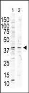 Mitogen-Activated Protein Kinase 13 antibody, 62-960, ProSci, Western Blot image 