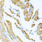 Collagen alpha-3(IX) chain antibody, A05963-1, Boster Biological Technology, Immunohistochemistry paraffin image 
