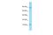 Microseminoprotein Beta antibody, A03041, Boster Biological Technology, Western Blot image 