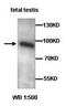 Acyl-CoA Dehydrogenase Medium Chain antibody, orb76996, Biorbyt, Western Blot image 