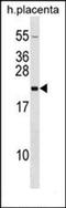 Cell Division Cycle 6 antibody, orb304718, Biorbyt, Western Blot image 