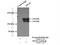 Amyloid Beta Precursor Like Protein 2 antibody, 15041-1-AP, Proteintech Group, Immunoprecipitation image 