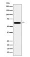 Heat Shock Transcription Factor 2 antibody, M04692-1, Boster Biological Technology, Western Blot image 