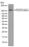 Platelet Derived Growth Factor Receptor Alpha antibody, 710169, Invitrogen Antibodies, Western Blot image 
