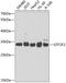 General Transcription Factor IIF Subunit 2 antibody, GTX54156, GeneTex, Western Blot image 