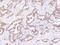 Keratin, type II cytoskeletal 6C antibody, 104198-T08, Sino Biological, Immunohistochemistry paraffin image 